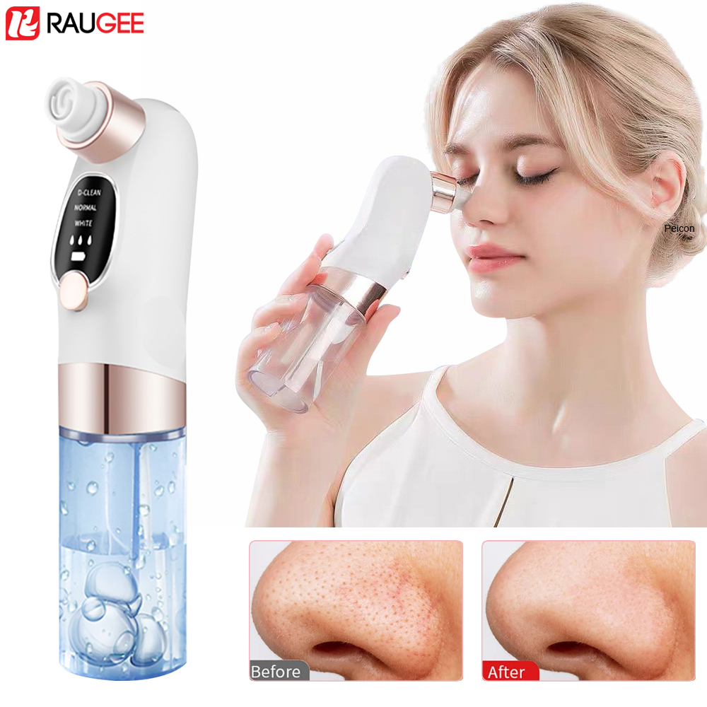 Pore Vacuum - Extractor de espinillas eléctrico, aspiradora de