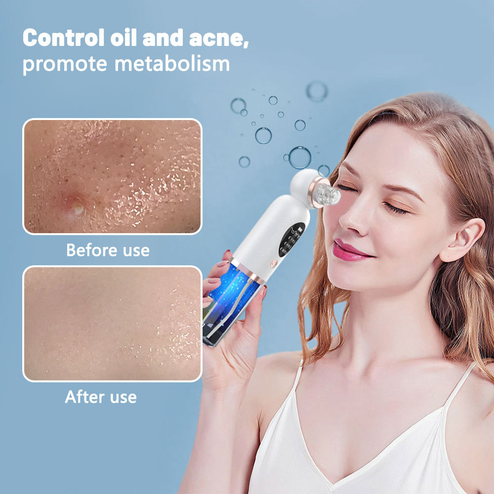Pore Vacuum - Removedor de Puntos Negros, Limpiador Facial