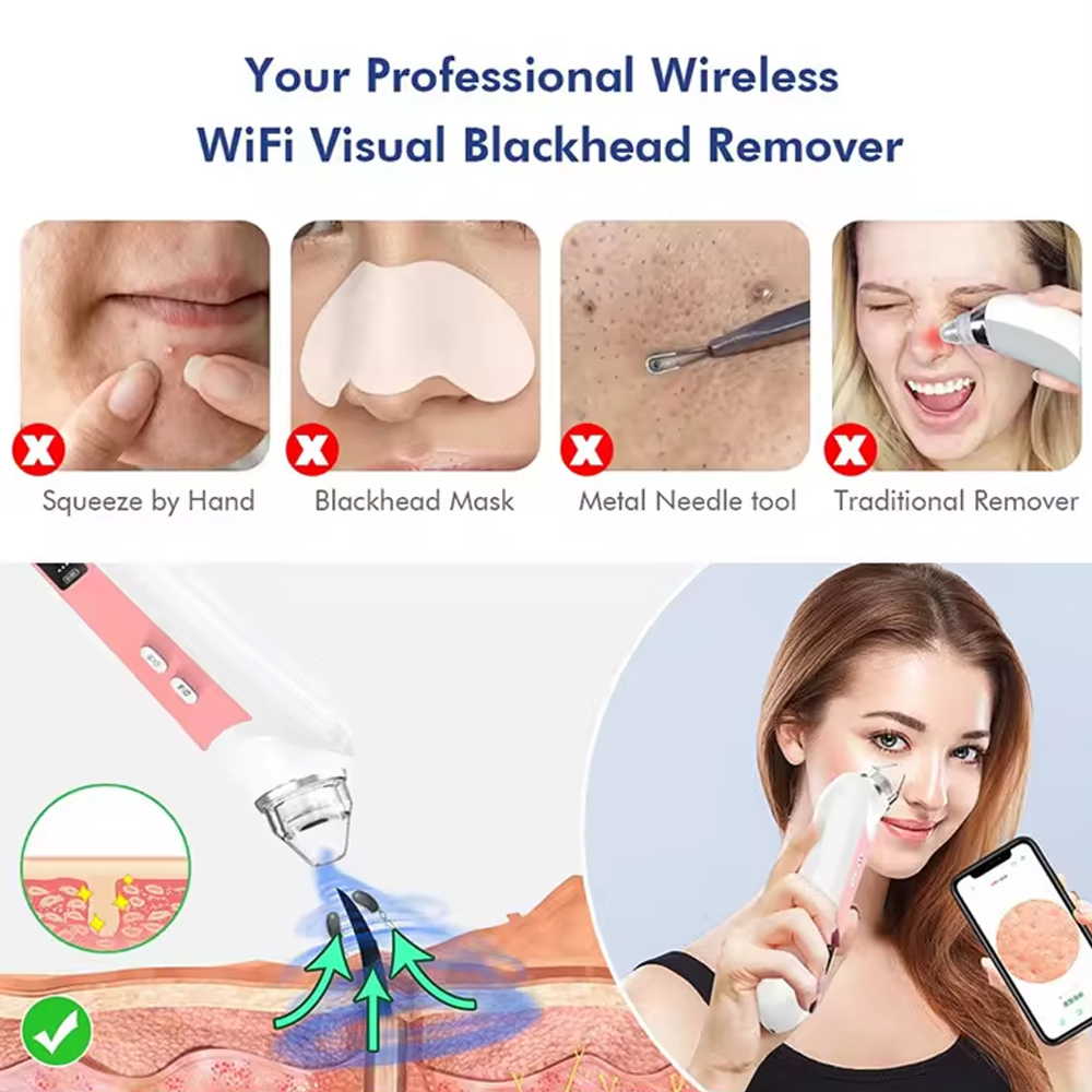 Limpiador de poros de 6 cabeza - Pore Vacuum reseña y precio