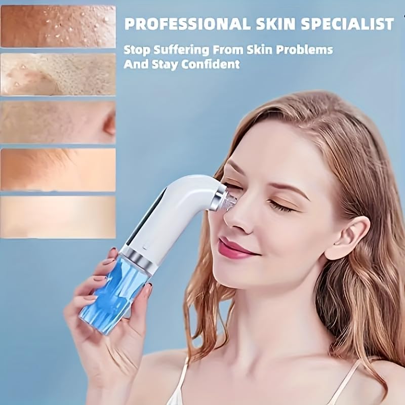 Removedor de espinillas, aspir - Pore Vacuum reseña y precio
