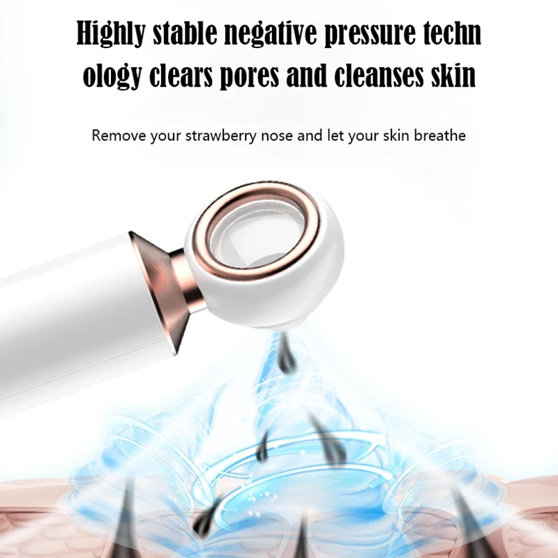 Removedor Eléctrico de Puntos  - Pore Vacuum reseña y precio