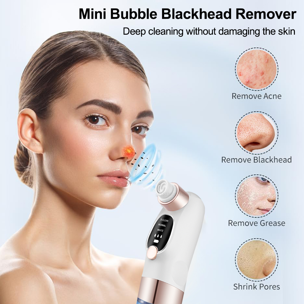 Extractor de espinillas eléctr - Pore Vacuum reseña y precio