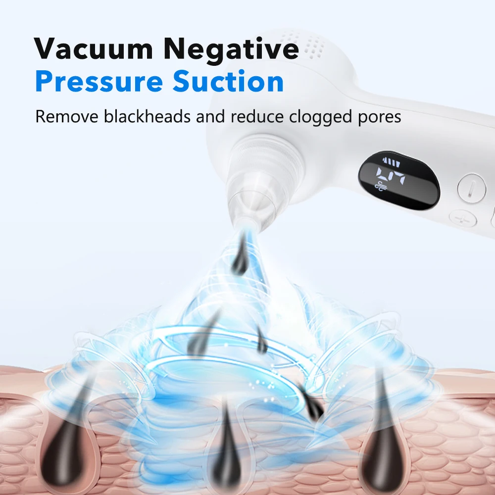 Aspirador de Puntos Negros Lim - Pore Vacuum reseña y precio