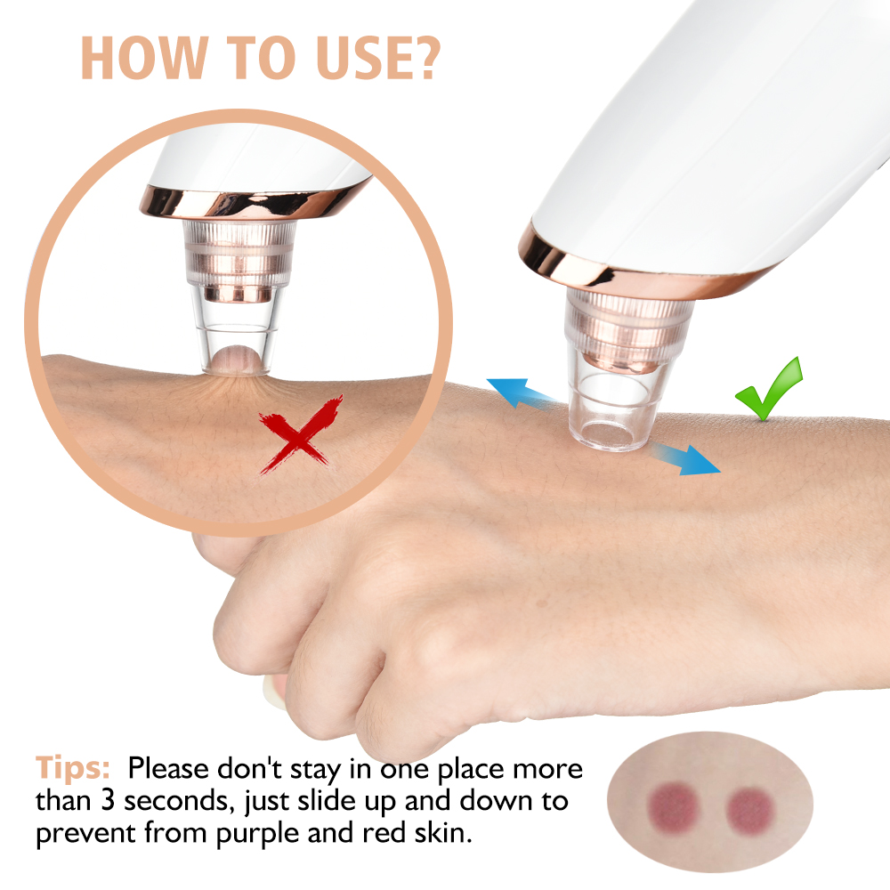Removedor de espinillas, limpi - Pore Vacuum reseña y precio