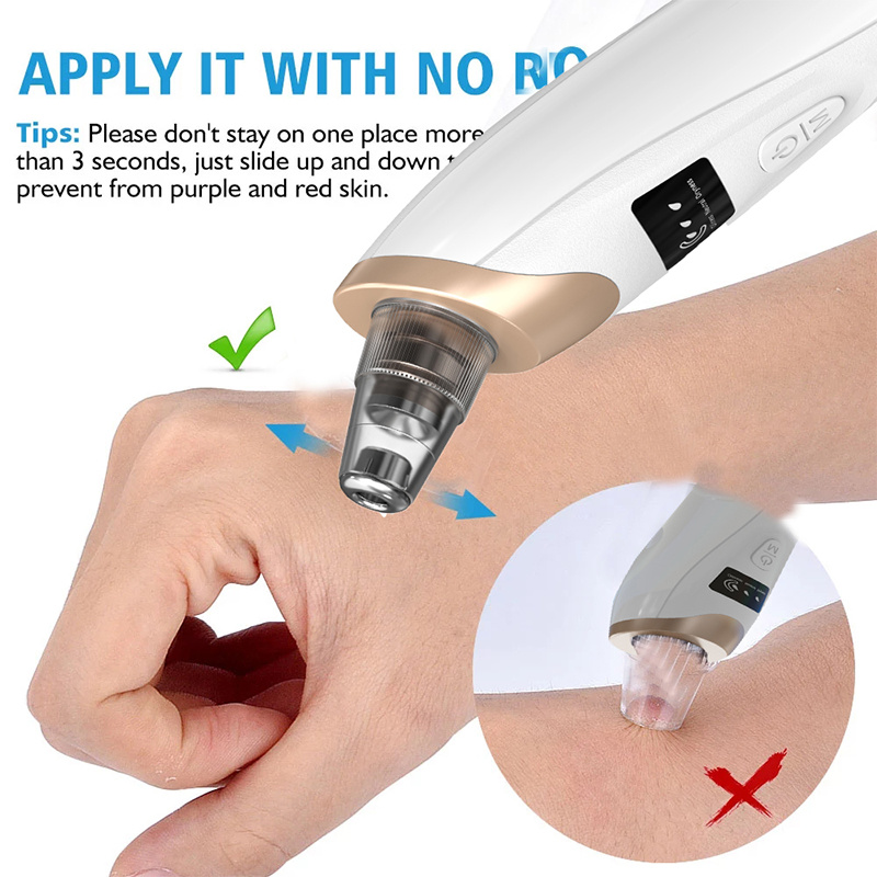 Removedor de espinillas, extra - Pore Vacuum reseña y precio