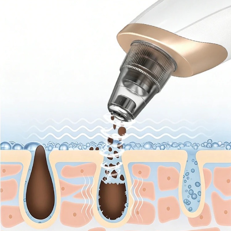 Removedor de Puntos Negros Rec - Pore Vacuum reseña y precio